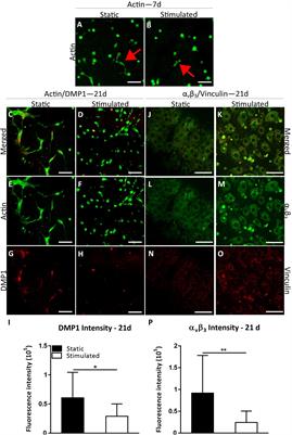 A Novel 3D Osteoblast and Osteocyte Model Revealing Changes in Mineralization and Pro-osteoclastogenic Paracrine Signaling During Estrogen Deficiency